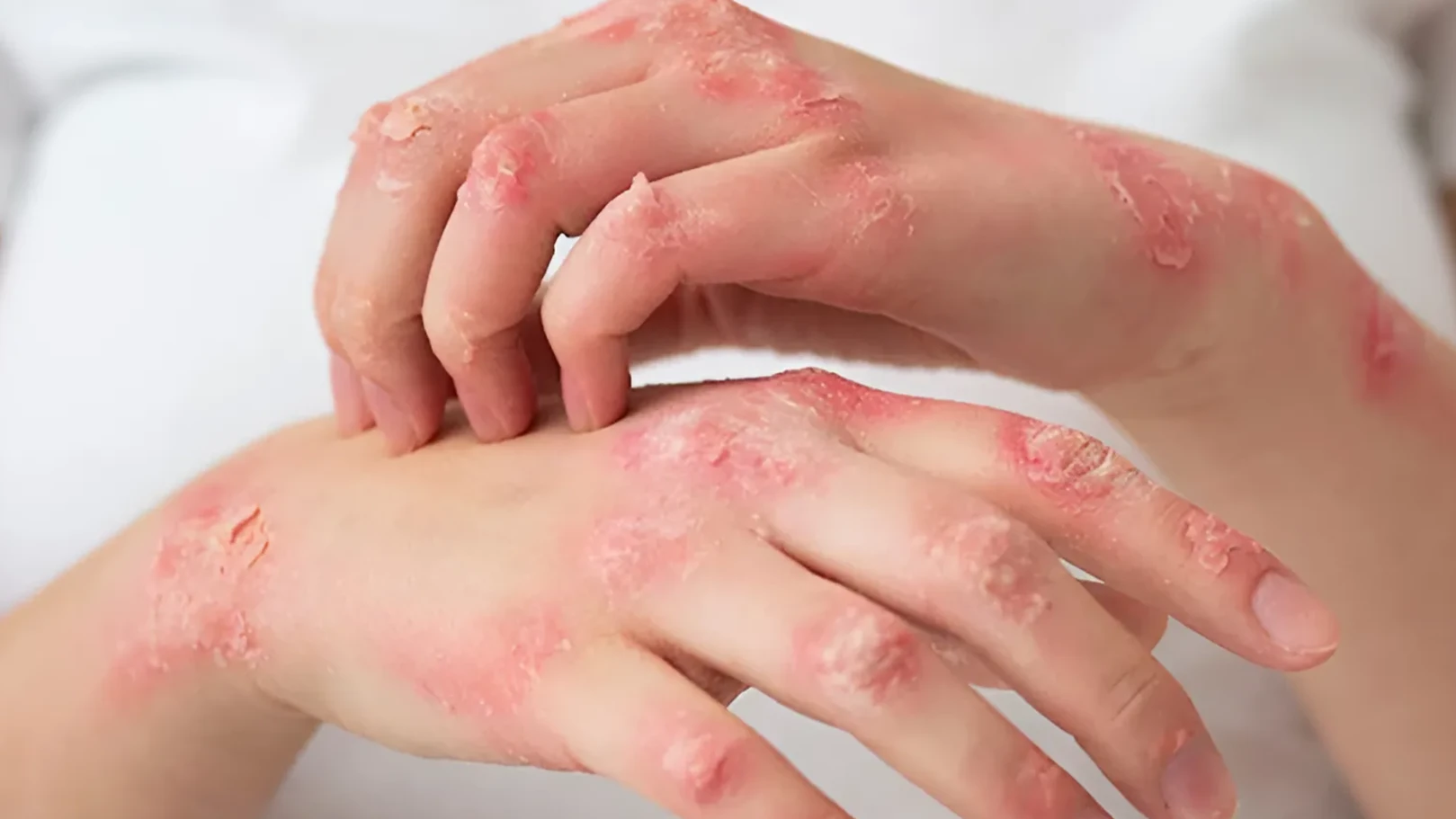 ĐẠO DIỄN TRỌNG TRINH: “TÔI BỊ THUYẾT PHỤC BỞI QUY TRÌNH KHÁM CHỮA BỆNH BẰNG CÔNG NGHỆ CAO”