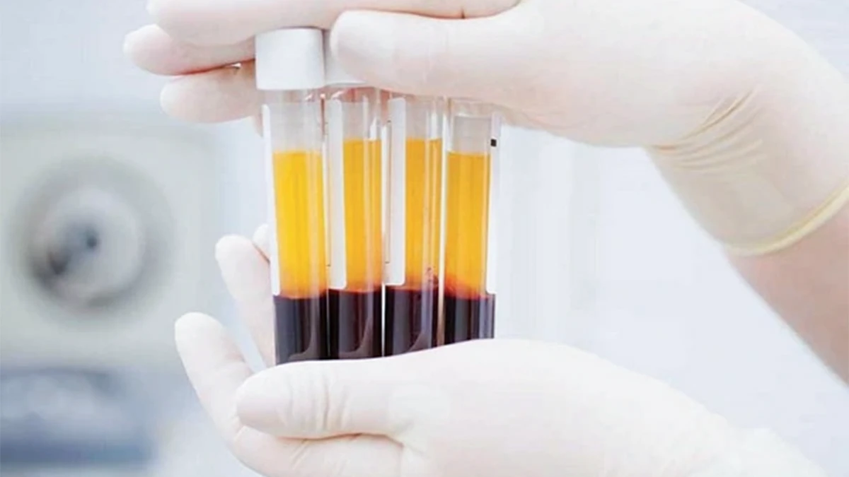 SỞ HỮU VẺ ĐẸP HOÀN MỸ CHỈ BẰNG PHƯƠNG PHÁP PRP PREMIUM