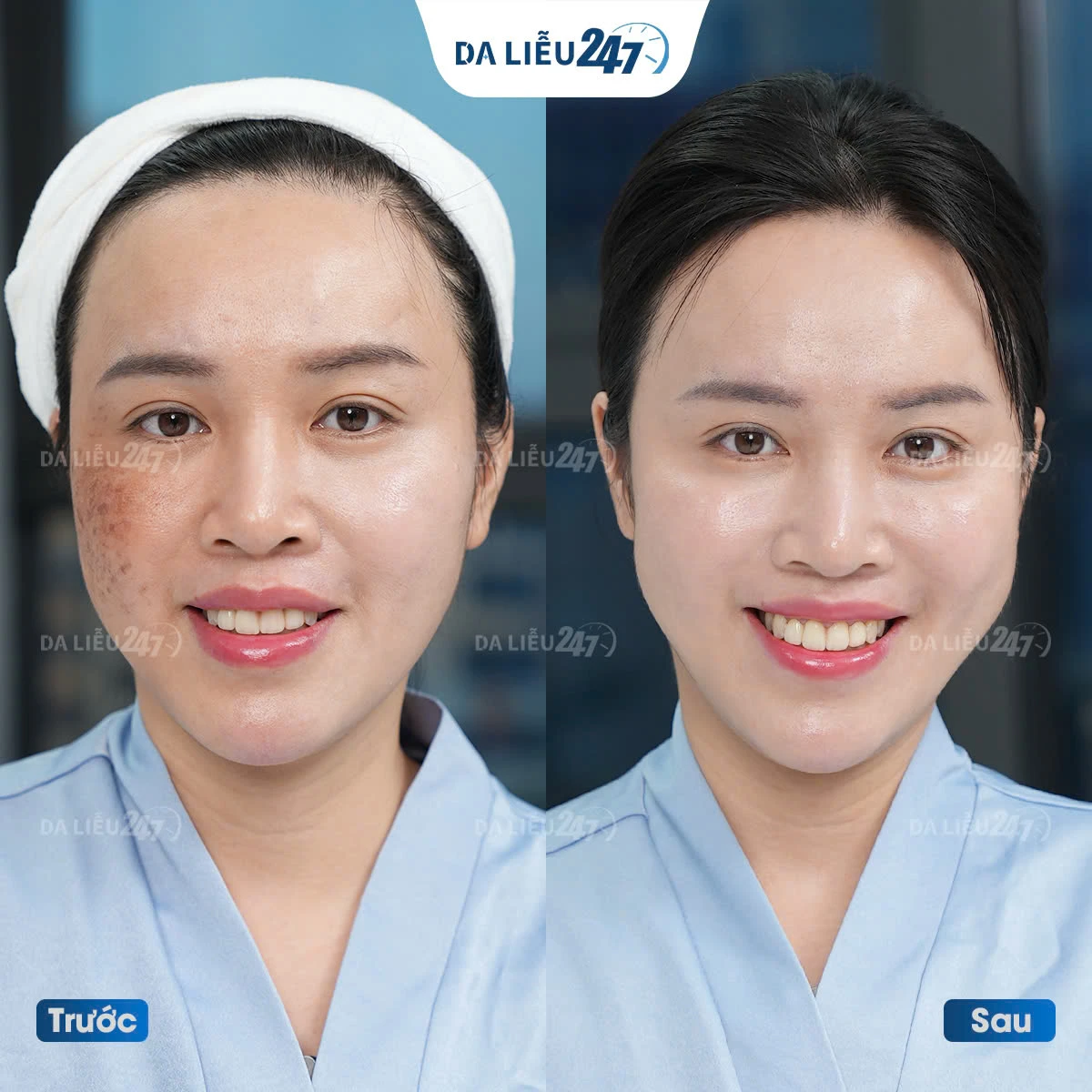 Lưu bản nháp tự động